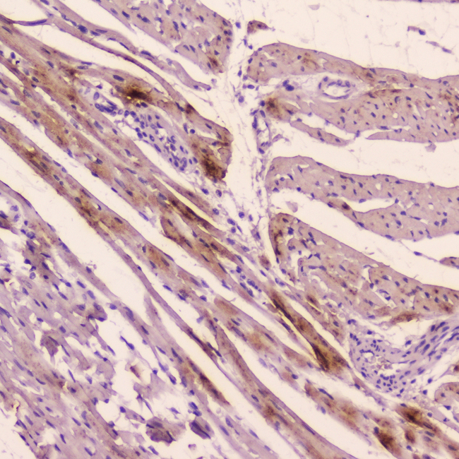 NPPA / ANP Antibody - IHC analysis of ANP using anti-ANP antibody. ANP was detected in paraffin-embedded section of rat cardiac muscle tissue. Heat mediated antigen retrieval was performed in citrate buffer (pH6, epitope retrieval solution) for 20 mins. The tissue section was blocked with 10% goat serum. The tissue section was then incubated with 2?g/ml rabbit anti-ANP Antibody overnight at 4?C. Biotinylated goat anti-rabbit IgG was used as secondary antibody and incubated for 30 minutes at 37?C. The tissue section was developed using Strepavidin-Biotin-Complex (SABC) with DAB as the chromogen.
