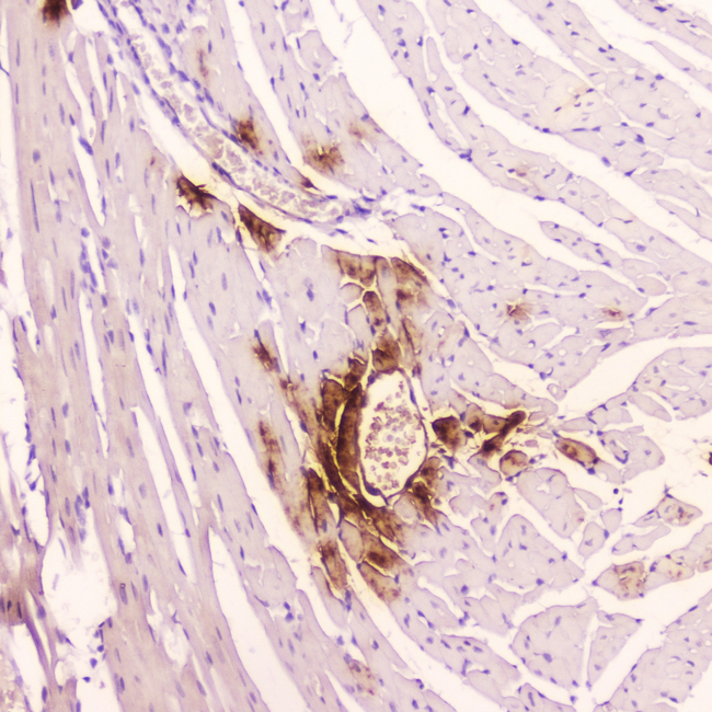 NPPA / ANP Antibody - IHC analysis of ANP using anti-ANP antibody. ANP was detected in paraffin-embedded section of mouse cardiac muscle tissue. Heat mediated antigen retrieval was performed in citrate buffer (pH6, epitope retrieval solution) for 20 mins. The tissue section was blocked with 10% goat serum. The tissue section was then incubated with 2?g/ml rabbit anti-ANP Antibody overnight at 4?C. Biotinylated goat anti-rabbit IgG was used as secondary antibody and incubated for 30 minutes at 37?C. The tissue section was developed using Strepavidin-Biotin-Complex (SABC) with DAB as the chromogen.