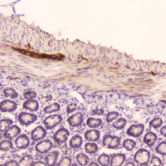 NPPA / ANP Antibody - IHC analysis of ANP using anti-ANP antibody. ANP was detected in paraffin-embedded section of rat small intestine tissue. Heat mediated antigen retrieval was performed in citrate buffer (pH6, epitope retrieval solution) for 20 mins. The tissue section was blocked with 10% goat serum. The tissue section was then incubated with 2µg/ml rabbit anti-ANP Antibody overnight at 4°C. Biotinylated goat anti-rabbit IgG was used as secondary antibody and incubated for 30 minutes at 37°C. The tissue section was developed using Strepavidin-Biotin-Complex (SABC) with DAB as the chromogen.