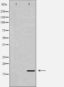 NPPA / ANP Antibody - Western blot analysis of extracts of PC-3 using NPPA antibody. The lane on the left is treated with the antigen-specific peptide.