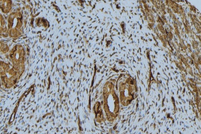 NPPA / ANP Antibody - 1:100 staining human uterus tissue by IHC-P. The sample was formaldehyde fixed and a heat mediated antigen retrieval step in citrate buffer was performed. The sample was then blocked and incubated with the antibody for 1.5 hours at 22°C. An HRP conjugated goat anti-rabbit antibody was used as the secondary.