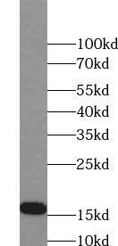 NPPA / ANP Antibody - HepG2 cells were subjected to SDS PAGE followed by western blot with NPPA antibody at dilution of 1:1000