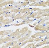 NPPA / ANP Antibody - Immunohistochemistry of paraffin-embedded rat heart tissue slide using NPPA antibody at dilution of 1:200