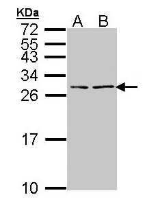 NPPB / BNP Antibody - Sample (30 ug of whole cell lysate). A: Hela, B: Hep G2 . 15% SDS PAGE. BNP antibody diluted at 1:1000.