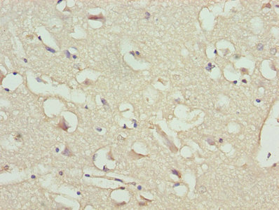 NPPB / BNP Antibody - Immunohistochemistry of paraffin-embedded human brain tissue using NPPB Antibody at dilution of 1:100