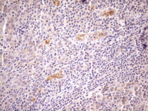 NPPB / BNP Antibody - Immunohistochemical staining of paraffin-embedded Human tonsil within the normal limits using anti-NPPB mouse monoclonal antibody. (Heat-induced epitope retrieval by 1mM EDTA in 10mM Tris buffer. (pH8.5) at 120°C for 3 min. (1:150)