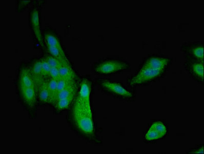 NPPB / BNP Antibody - Immunofluorescent analysis of Hela cells using NPPB Antibody at dilution of 1:100 and Alexa Fluor 488-congugated AffiniPure Goat Anti-Rabbit IgG(H+L)