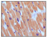 NPPB / BNP Antibody - IHC of paraffin-embedded human normal myocardium, showing cytoplasmic localization using BNP3 mouse monoclonal antibody with DAB staining.