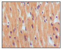 NPPB / BNP Antibody - IHC of paraffin-embedded human normal myocardium, showing cytoplasmic localization using BNP1 mouse monoclonal antibody with DAB staining.