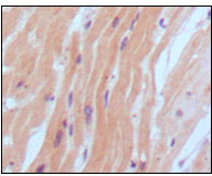 NPPB / BNP Antibody - IHC of paraffin-embedded human normal myocardium, showing cytoplasmic localization using BNP2 mouse monoclonal antibody with DAB staining.