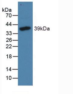 NPPB / BNP Antibody