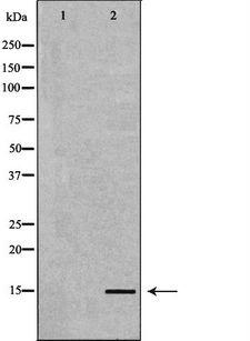 NPPB / BNP Antibody - Western blot analysis of extracts of human plasma using NPPB antibody. The lane on the left is treated with the antigen-specific peptide.