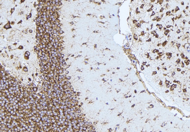 NPPB / BNP Antibody - 1:100 staining mouse brain tissue by IHC-P. The sample was formaldehyde fixed and a heat mediated antigen retrieval step in citrate buffer was performed. The sample was then blocked and incubated with the antibody for 1.5 hours at 22°C. An HRP conjugated goat anti-rabbit antibody was used as the secondary.