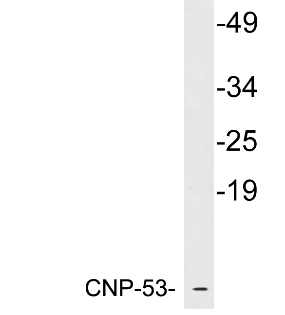 NPPC Antibody - Western blot analysis of lysates from K562 cells, using CNP-53 antibody.