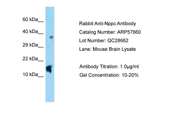 NPPC Antibody -  This image was taken for the unconjugated form of this product. Other forms have not been tested.