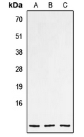 NPPC Antibody - Western blot analysis of NPPC expression in HEK293T (A); mouse heart (B); rat heart (C) whole cell lysates.