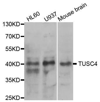 NPR2L / TUSC4 Antibody - Western blot analysis of extracts of various cell lines.