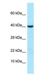 NPR3 Antibody - NPR3 antibody Western Blot of HeLa.  This image was taken for the unconjugated form of this product. Other forms have not been tested.