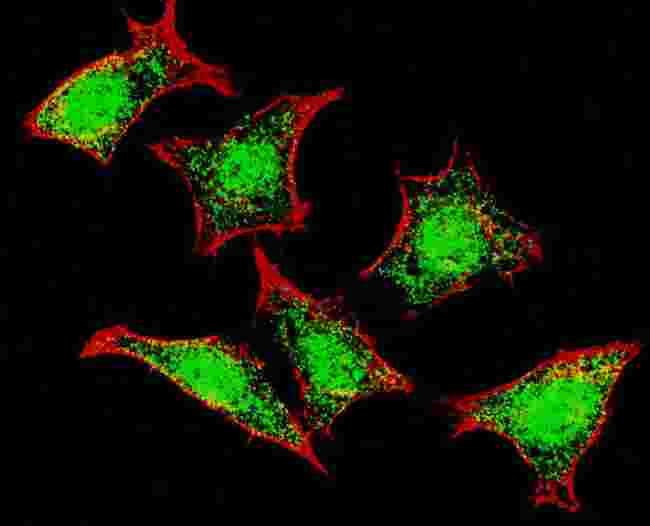 NPR3 Antibody - Fluorescent confocal image of HeLa cells stained with Natriuretic Peptide Receptor C antibody. HeLa cells were fixed with 4% PFA (20 min), permeabilized with Triton X-100 (0.2%, 30 min). Cells were then incubated Natriuretic Peptide Receptor C primary antibody (1:200, 2 h at room temperature). For secondary antibody, Alexa Fluor 488 conjugated donkey anti-rabbit antibody (green) was used (1:1000, 1h). Nuclei were counterstained with Hoechst 33342 (blue) (10 ug/ml, 5 min). Note the highly specific localization of the Natriuretic Peptide Receptor C mainly to the mainly to the nucleus.