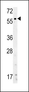 NPR3 Antibody - Western blot of ANPC-S82 in NCI-H460,HL-60 cell line lysates (35 ug/lane). ANPC (arrow) was detected using the purified antibody.