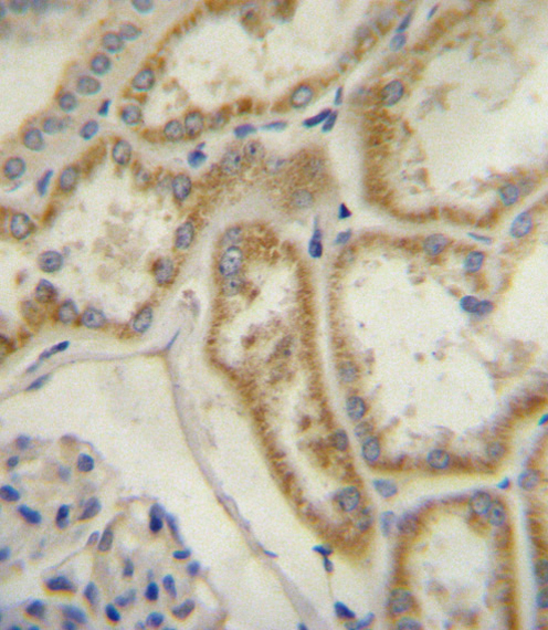 NPR3 Antibody - Natriuretic Peptide Receptor C (NPR3/ANPC) Antibody immunohistochemistry of formalin-fixed and paraffin-embedded human kidney tissue followed by peroxidase-conjugated secondary antibody and DAB staining.This data demonstrates the use of Natriuretic Peptide Receptor C (NPR3/ANPC) Antibody for immunohistochemistry.