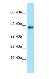 NPR3 Antibody - NPR3 antibody Western Blot of Fetal kidney.  This image was taken for the unconjugated form of this product. Other forms have not been tested.