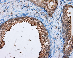 NPR3 Antibody - IHC of paraffin-embedded prostate tissue using anti- mouse monoclonal antibody. (Dilution 1:50).