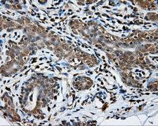 NPR3 Antibody - IHC of paraffin-embedded breast tissue using anti-NPR3 mouse monoclonal antibody. (Dilution 1:50).