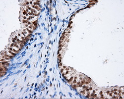 NPR3 Antibody - IHC of paraffin-embedded prostate tissue using anti-NPR3 mouse monoclonal antibody. (Dilution 1:50).