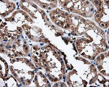 NPR3 Antibody - IHC of paraffin-embedded Kidney tissue using anti-NPR3 mouse monoclonal antibody. (Dilution 1:50).