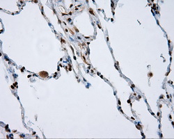 NPR3 Antibody - IHC of paraffin-embedded lung tissue using anti- mouse monoclonal antibody. (Dilution 1:50).