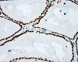 NPR3 Antibody - IHC of paraffin-embedded thyroid tissue using anti- mouse monoclonal antibody. (Dilution 1:50).