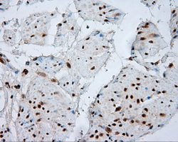 NPR3 Antibody - IHC of paraffin-embedded bladder tissue using anti- mouse monoclonal antibody. (Dilution 1:50).