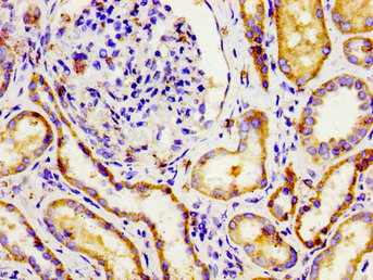 NPR3 Antibody - Immunohistochemistry image of paraffin-embedded human kidney tissue at a dilution of 1:100