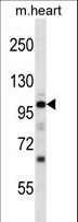 NPRA / NPR1 Antibody - Mouse Npr1 Antibody western blot of mouse heart tissue lysates (35 ug/lane). The Npr1 antibody detected the Npr1 protein (arrow).