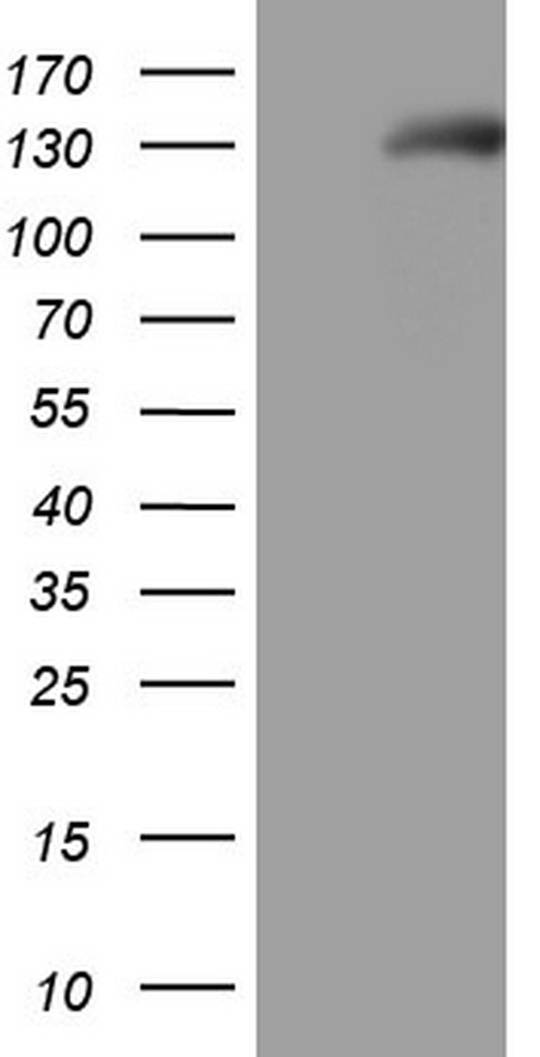 NPRA / NPR1 Antibody - HEK293T cells were transfected with the pCMV6-ENTRY control (Left lane) or pCMV6-ENTRY NPR1 (Right lane) cDNA for 48 hrs and lysed. Equivalent amounts of cell lysates (5 ug per lane) were separated by SDS-PAGE and immunoblotted with anti-NPR1.
