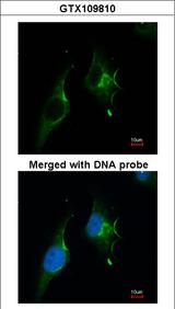 NPRA / NPR1 Antibody - Immunofluorescence of paraformaldehyde-fixed HeLa, using NPR-A antibody at 1:200 dilution.
