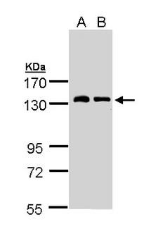 NPRA / NPR1 Antibody - Sample (30 ug of whole cell lysate). A: H1299. B: Raji. 7.5% SDS PAGE. NPR1 antibody diluted at 1:3000