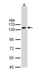 NPRA / NPR1 Antibody - Sample (30 ug of whole cell lysate). A: Hela. 7.5% SDS PAGE. NPR1 antibody diluted at 1:1000