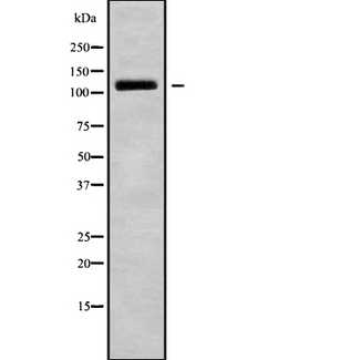NPRA / NPR1 Antibody - Western blot analysis NPR1 using HT29 whole cells lysates