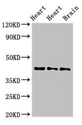 NPSR1 / NPSR / GPR154 Antibody - Western Blot Positive WB detected in:Rat heart tissue,Mouse heart tissue,Mouse brain tissue All Lanes:NPSR1 antibody at 4µg/ml Secondary Goat polyclonal to rabbit IgG at 1/50000 dilution Predicted band size: 43,36,45,44,42,19,16,17,11 KDa Observed band size: 43 KDa