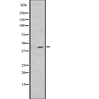NPSR1 / NPSR / GPR154 Antibody - Western blot analysis of NPSR1 expression in HEK293 cells. The lane on the left is treated with the antigen-specific peptide.