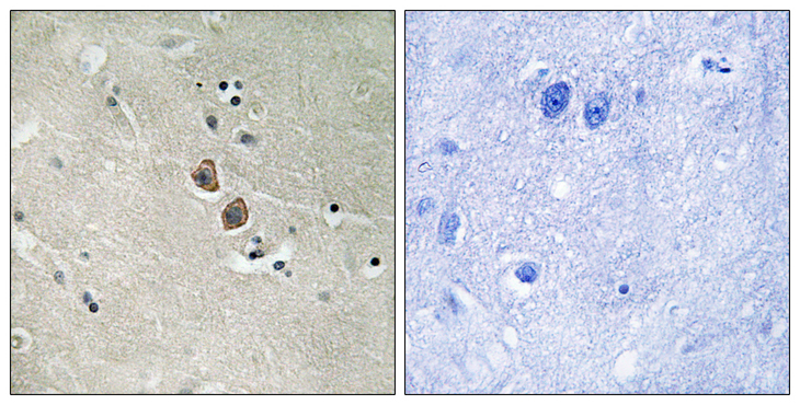 NPTN / SDR1 Antibody - Immunohistochemistry analysis of paraffin-embedded human brain tissue, using NPTN Antibody. The picture on the right is blocked with the synthesized peptide.