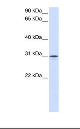 NPTN / SDR1 Antibody - Fetal muscle lysate. Antibody concentration: 1.0 ug/ml. Gel concentration: 12%.  This image was taken for the unconjugated form of this product. Other forms have not been tested.