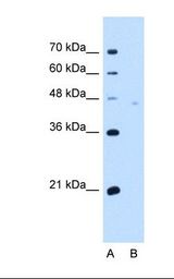 NPTN / SDR1 Antibody - Lane A: Marker. Lane B: HepG2 cell lysate. Antibody concentration: 5.0 ug/ml. Gel concentration: 12%.  This image was taken for the unconjugated form of this product. Other forms have not been tested.