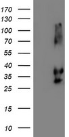 NPTN / SDR1 Antibody - HEK293T cells were transfected with the pCMV6-ENTRY control (Left lane) or pCMV6-ENTRY NPTN (Right lane) cDNA for 48 hrs and lysed. Equivalent amounts of cell lysates (5 ug per lane) were separated by SDS-PAGE and immunoblotted with anti-NPTN.