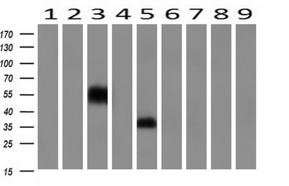 NPTN / SDR1 Antibody - Western blot of extracts (10ug) from 9 Human tissue by using anti-NPTN monoclonal antibody at 1:200 (1: Testis; 2: Omentum; 3: Uterus; 4: Breast; 5: Brain; 6: Liver; 7: Ovary; 8: Thyroid gland; 9: Colon).