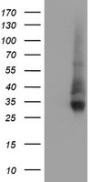 NPTN / SDR1 Antibody - HEK293T cells were transfected with the pCMV6-ENTRY control (Left lane) or pCMV6-ENTRY NPTN (Right lane) cDNA for 48 hrs and lysed. Equivalent amounts of cell lysates (5 ug per lane) were separated by SDS-PAGE and immunoblotted with anti-NPTN.