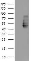 NPTN / SDR1 Antibody - HEK293T cells were transfected with the pCMV6-ENTRY control (Left lane) or pCMV6-ENTRY NPTN (Right lane) cDNA for 48 hrs and lysed. Equivalent amounts of cell lysates (5 ug per lane) were separated by SDS-PAGE and immunoblotted with anti-NPTN.