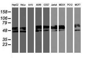 NPTN / SDR1 Antibody - Western blot of extracts (35 ug) from 9 different cell lines by using anti-NPTN monoclonal antibody.